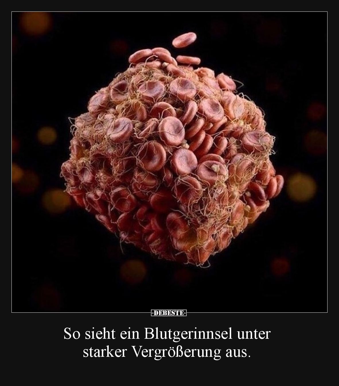 So sieht ein Blutgerinnsel unter starker Vergrößerung aus.