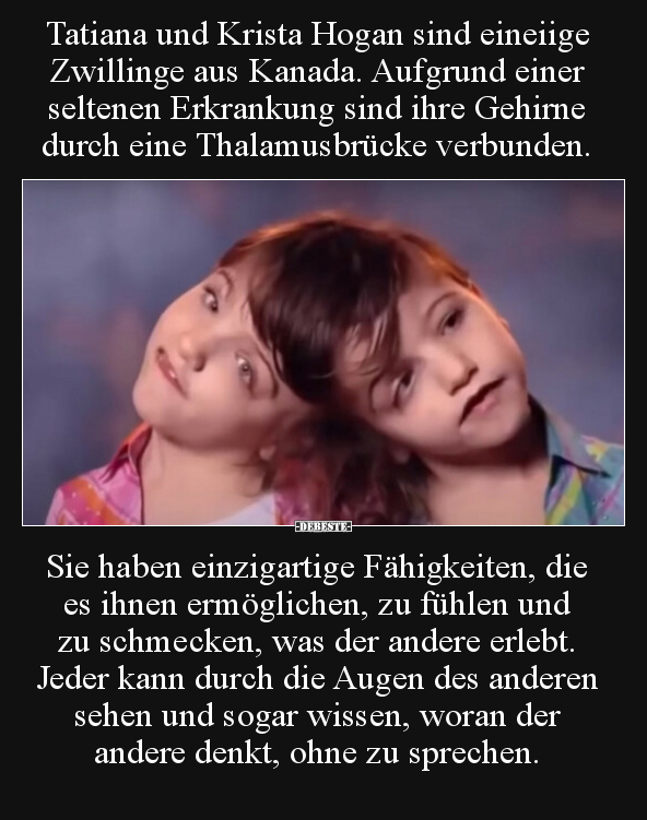 Tatiana und Krista Hogan sind eineiige Zwillinge aus.. - Lustige Bilder | DEBESTE.de