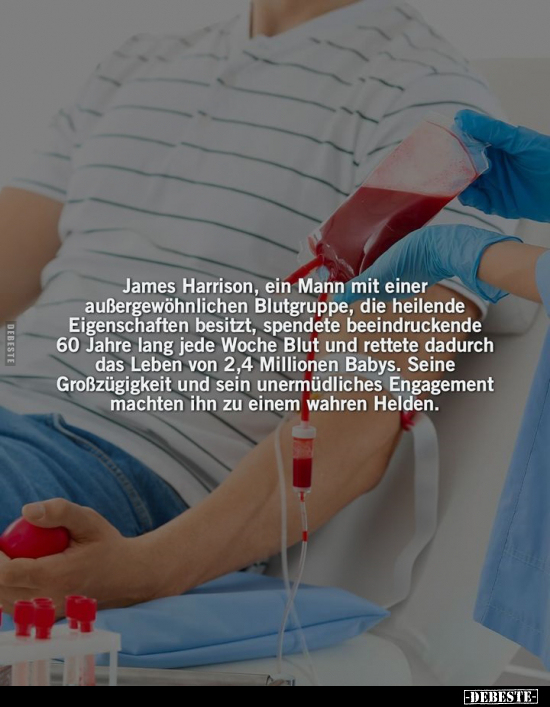 James Harrison, ein Mann mit einer außergewöhnlichen.. - Lustige Bilder | DEBESTE.de