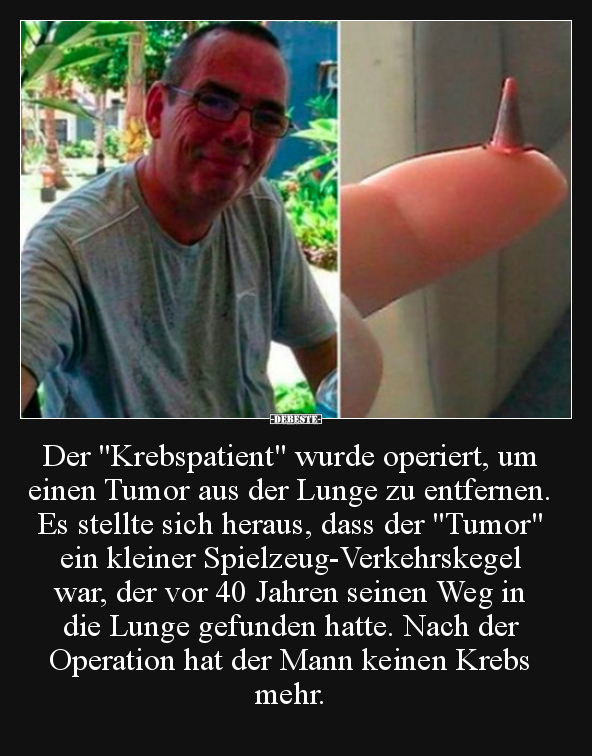 Der "Krebspatient" wurde operiert, um einen Tumor aus der.. - Lustige Bilder | DEBESTE.de