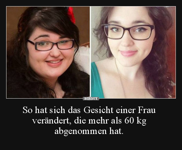 So hat sich das Gesicht einer Frau verändert, die mehr.. - Lustige Bilder | DEBESTE.de