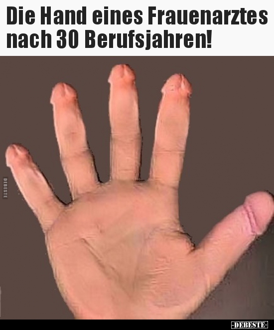 Die Hand eines Frauenarztes nach 30 Berufsjahren!.. - Lustige Bilder | DEBESTE.de