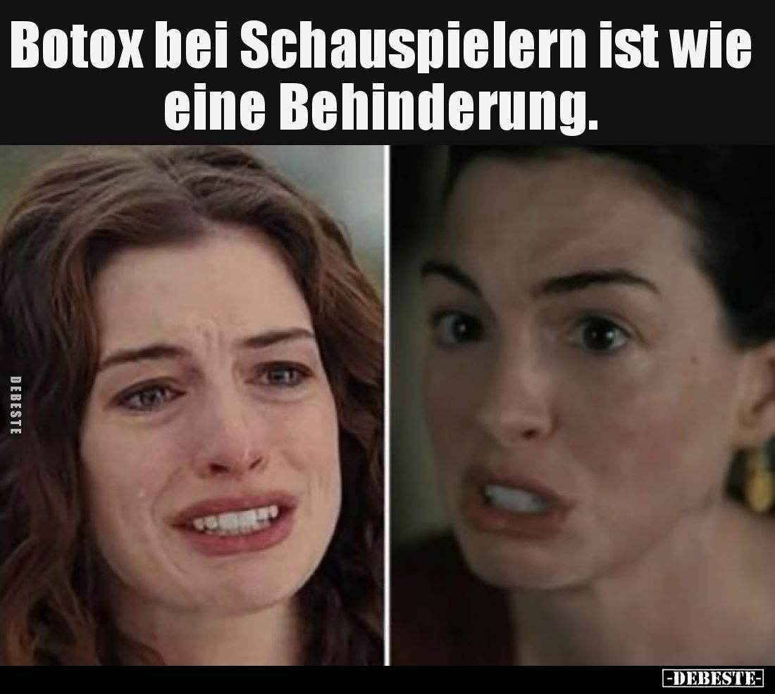 Botox bei Schauspielern ist wie eine Behinderung... - Lustige Bilder | DEBESTE.de