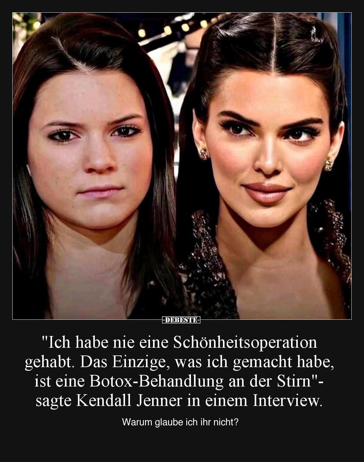 "Ich habe nie eine Schönheitsoperation gehabt. Das Einzige, was ich gemacht habe, ist eine Botox-Behandlung an der Stirn...