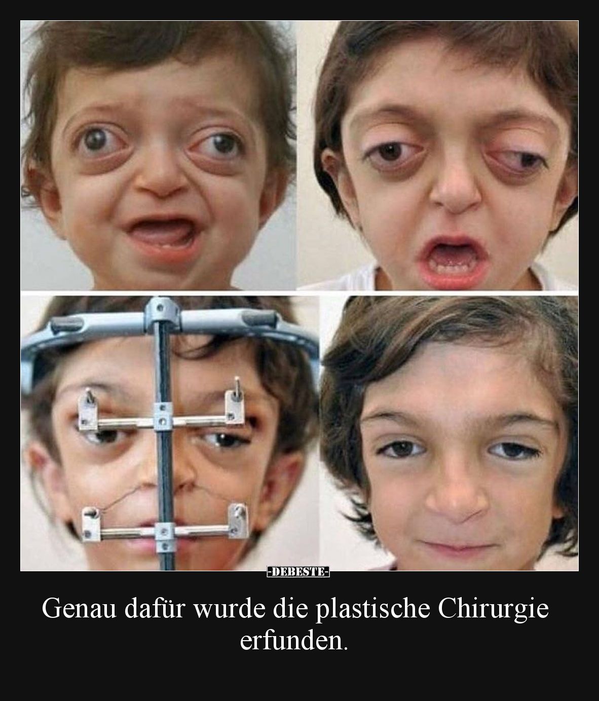Genau dafür wurde die plastische Chirurgie erfunden... - Lustige Bilder | DEBESTE.de