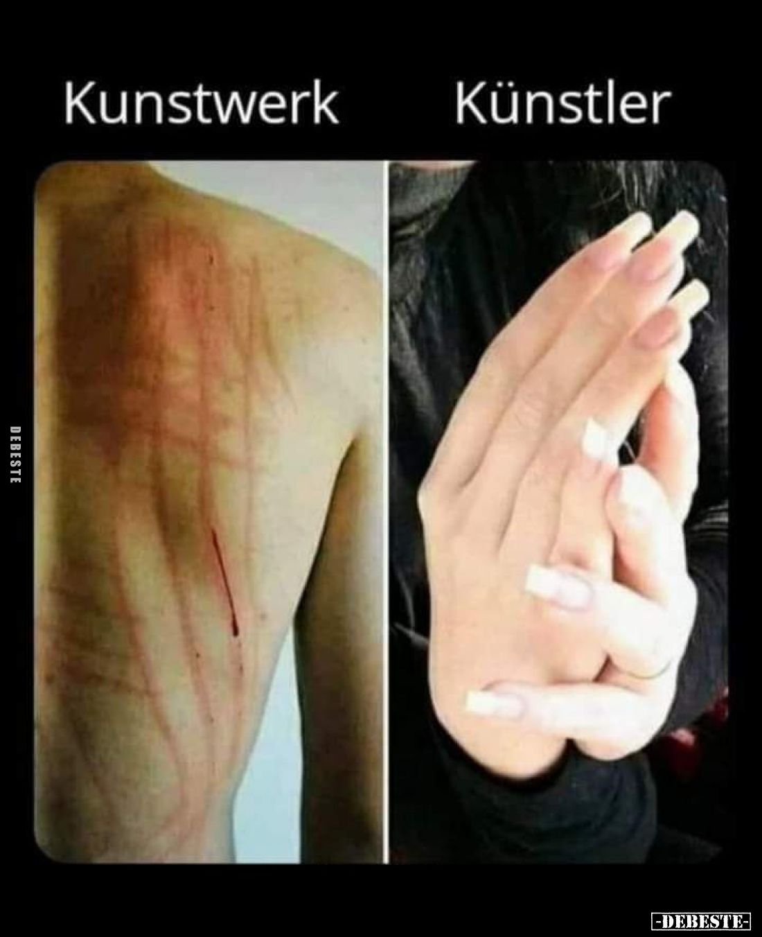 Kunstwerk vs
Künstler.