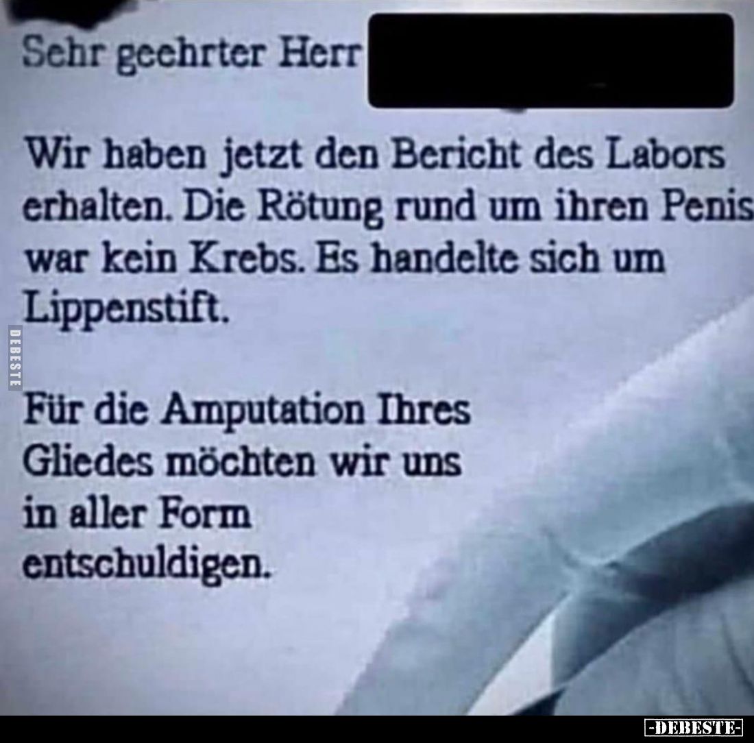Sehr geehrter Herr
Wir haben jetzt den Bericht des Labors erhalten. Die Rötung rund um ihren Penis war kein Krebs. Es handel...