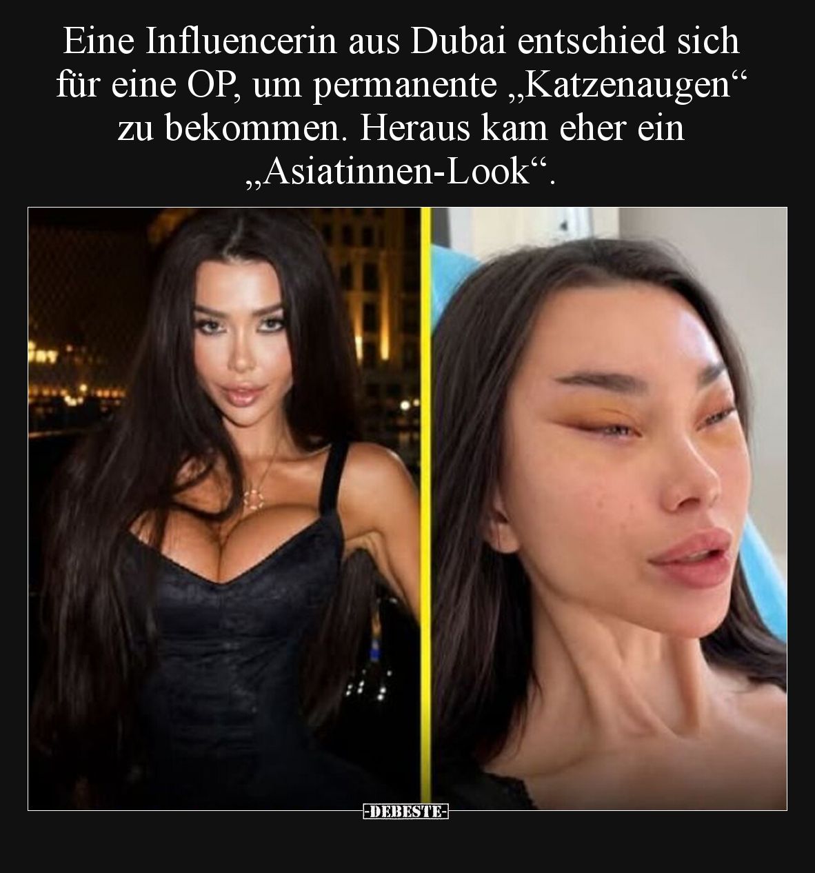 Eine Influencerin aus Dubai entschied sich für eine OP, um permanente „Katzenaugen“ zu bekommen. Heraus kam eher ein „Asiatin...