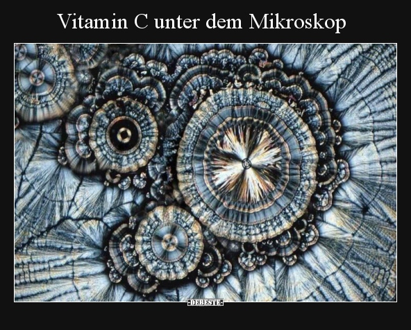 Vitamin C unter dem Mikroskop.. - Lustige Bilder | DEBESTE.de