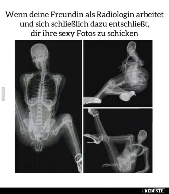 Wenn deine Freundin als Radiologin arbeitet und sich.. - Lustige Bilder | DEBESTE.de