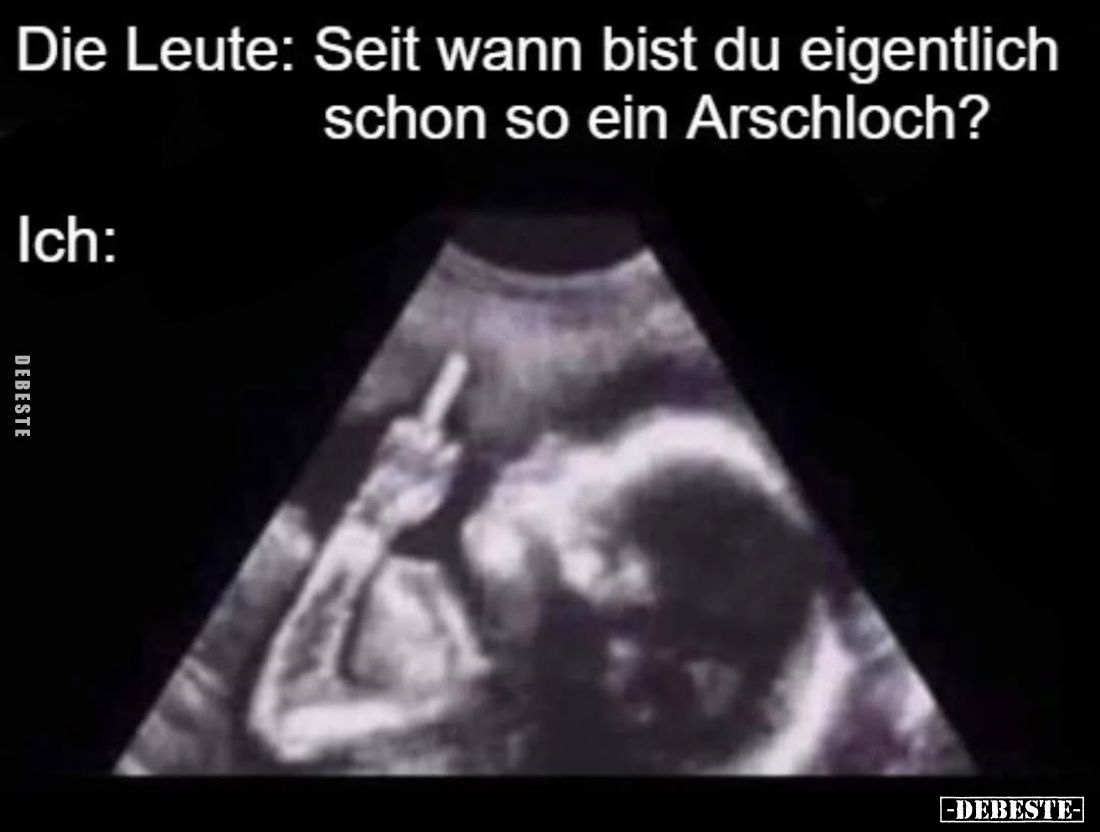 Die Leute: Seit wann bist du eigentlich schon so ein Arschloch?