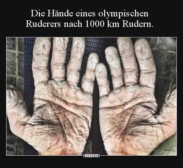 Die Hände eines olympischen Ruderers nach 1000 km.. - Lustige Bilder | DEBESTE.de