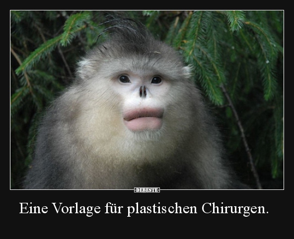Eine Vorlage für plastischen Chirurgen...