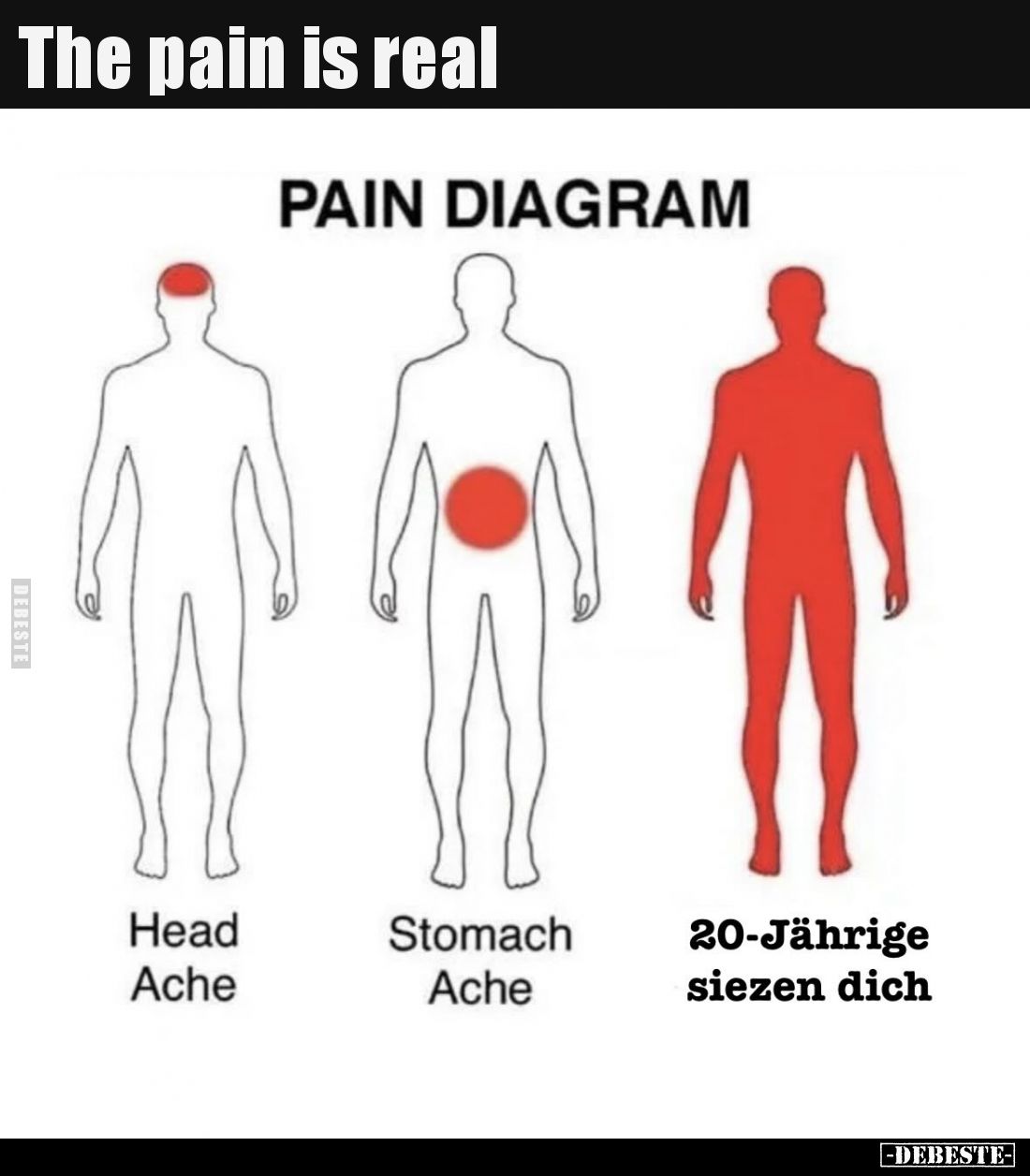 The pain is real
-
Pain Diagram
