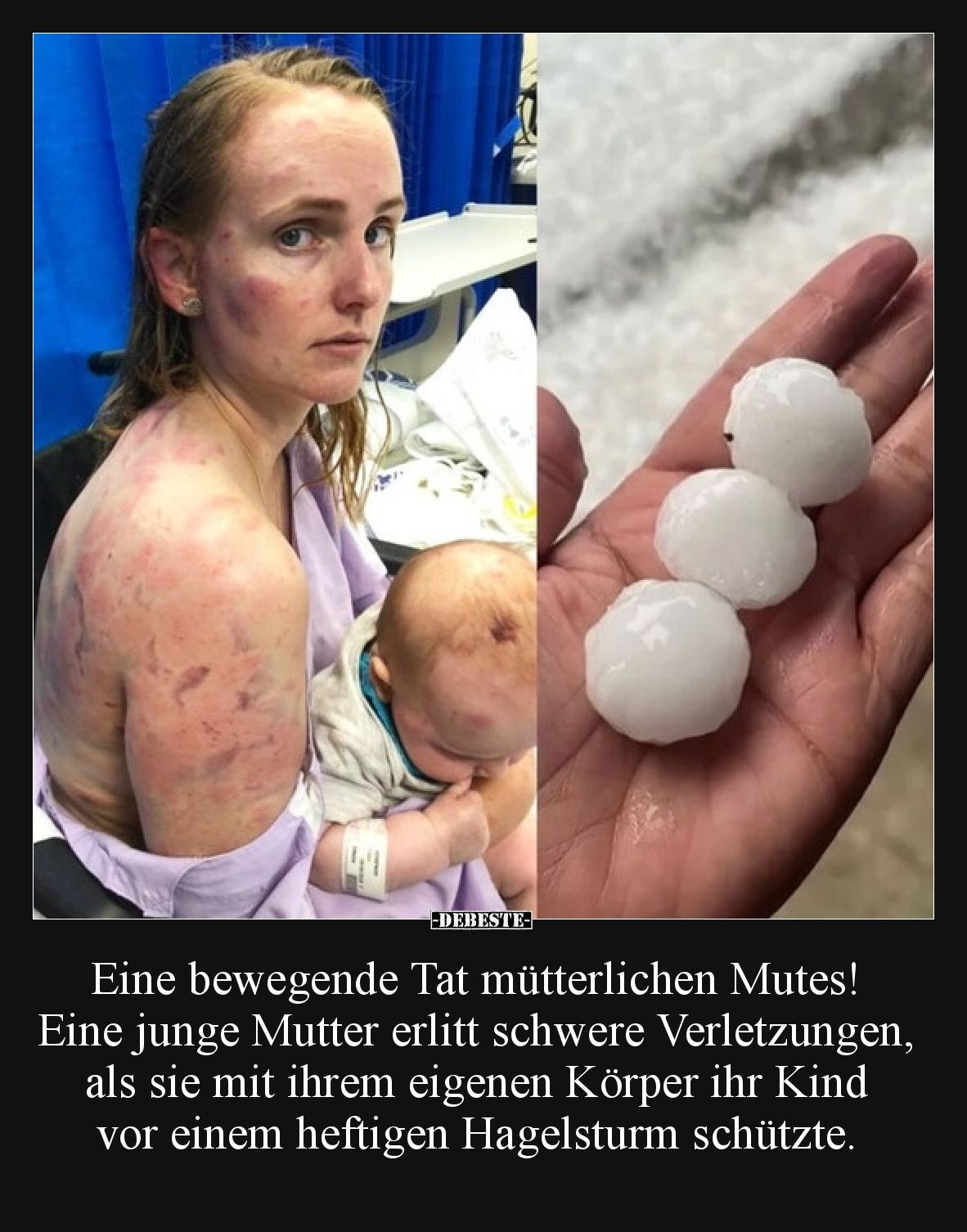 Eine bewegende Tat mütterlichen Mutes! Eine junge Mutter erlitt schwere Verletzungen, als sie mit ihrem eigenen Körper ihr Ki...