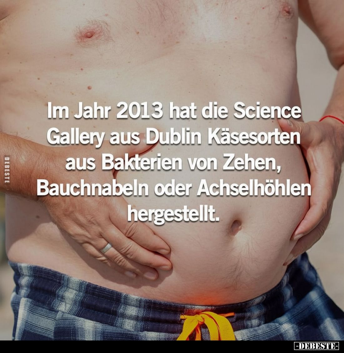 Im Jahr 2013 hat die Science Gallery aus Dublin Käsesorten aus Bakterien von Zehen, Bauchnabeln oder Achselhöhlen hergestellt...