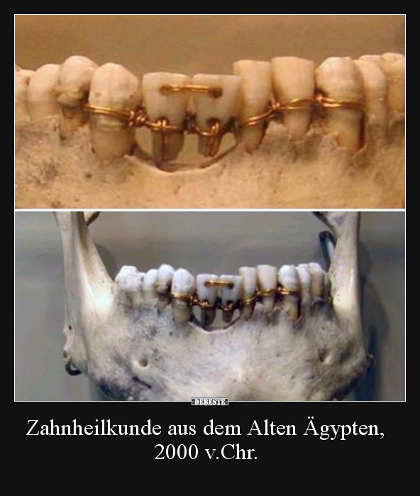 Zahnheilkunde aus dem Alten Ägypten, 2000 v.Chr... - Lustige Bilder | DEBESTE.de
