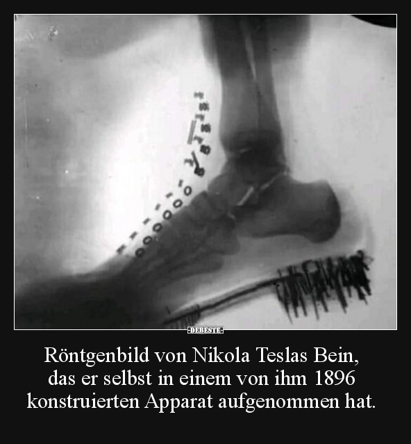 Röntgenbild von Nikola Teslas Bein, das er selbst in.. - Lustige Bilder | DEBESTE.de