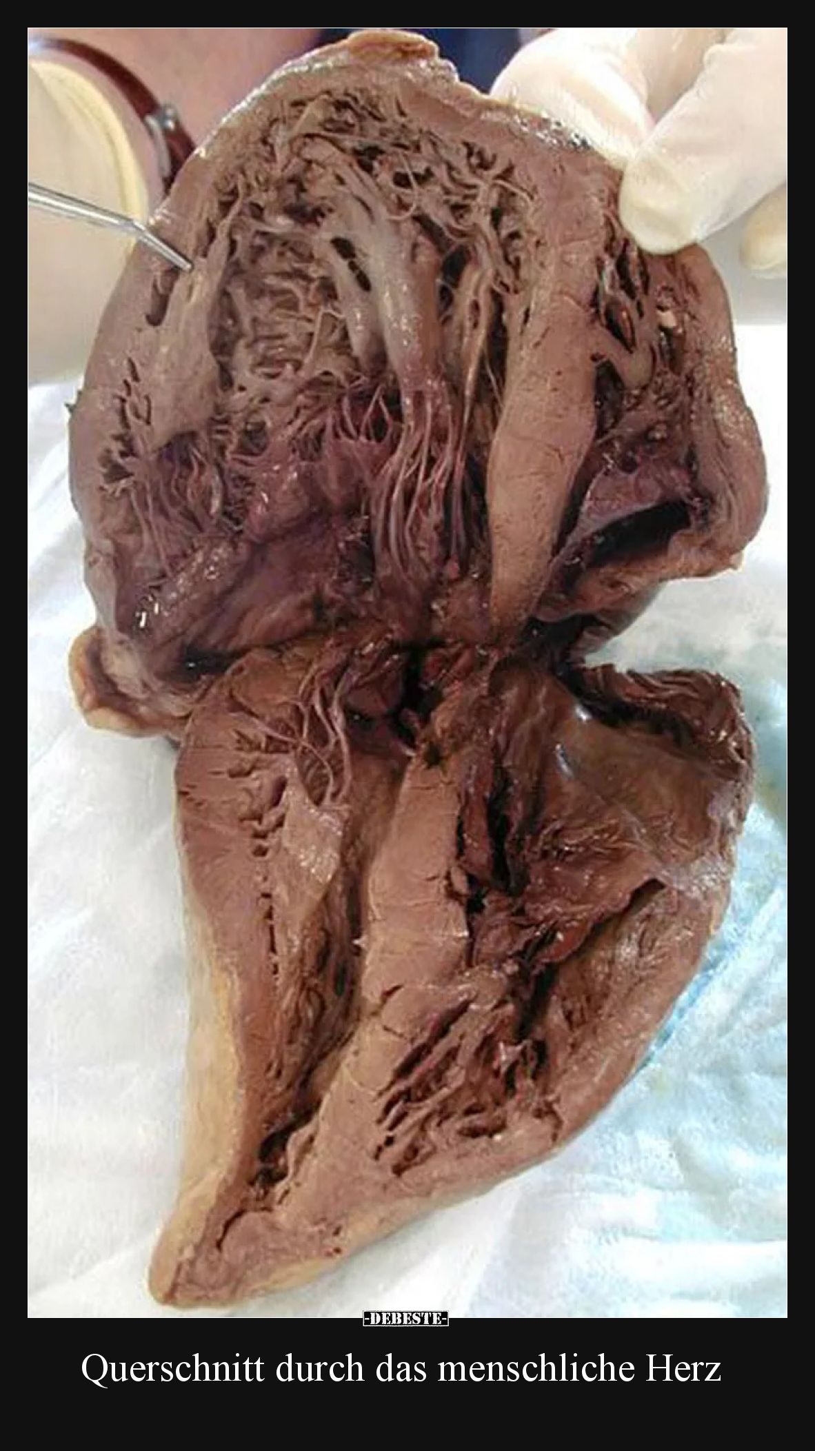 Querschnitt durch das menschliche Herz