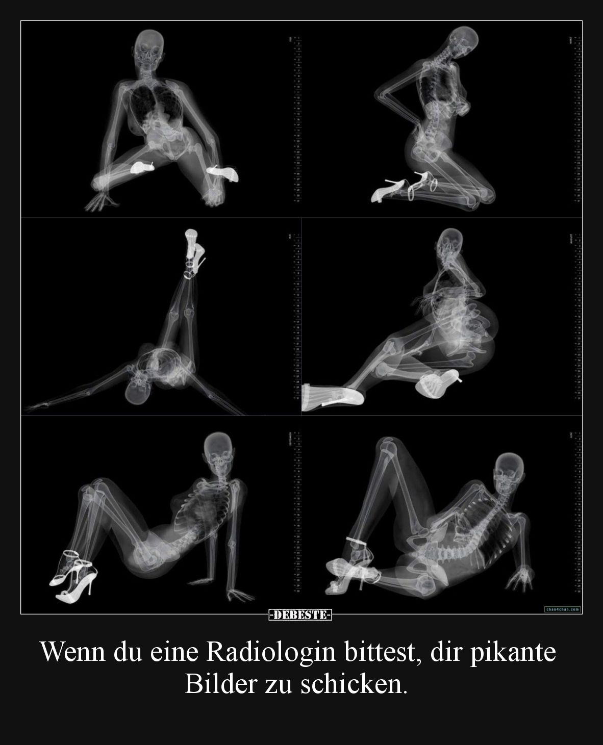 Wenn du eine Radiologin bittest, dir pikante Bilder zu schicken.