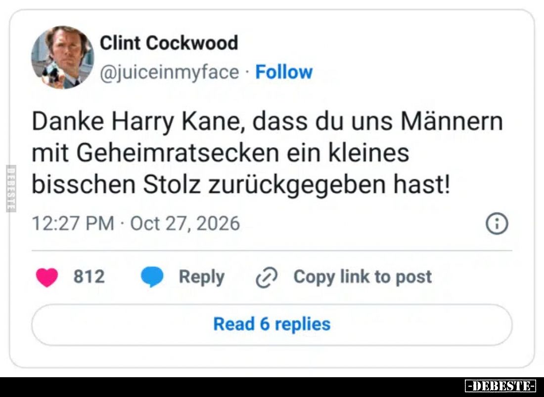 Danke Harry Kane, dass du uns Männern mit Geheimratsecken ein kleines bisschen Stolz zurückgegeben hast!