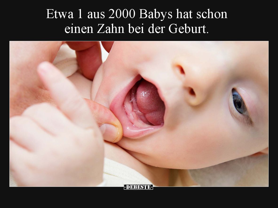 Etwa 1 aus 2000 Babys hat schon einen Zahn bei der Geburt... - Lustige Bilder | DEBESTE.de