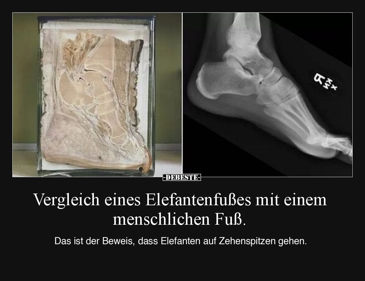 Vergleich eines Elefantenfußes mit einem menschlichen Fuß.

Das ist der Beweis, dass Elefanten auf Zehenspitzen gehen.