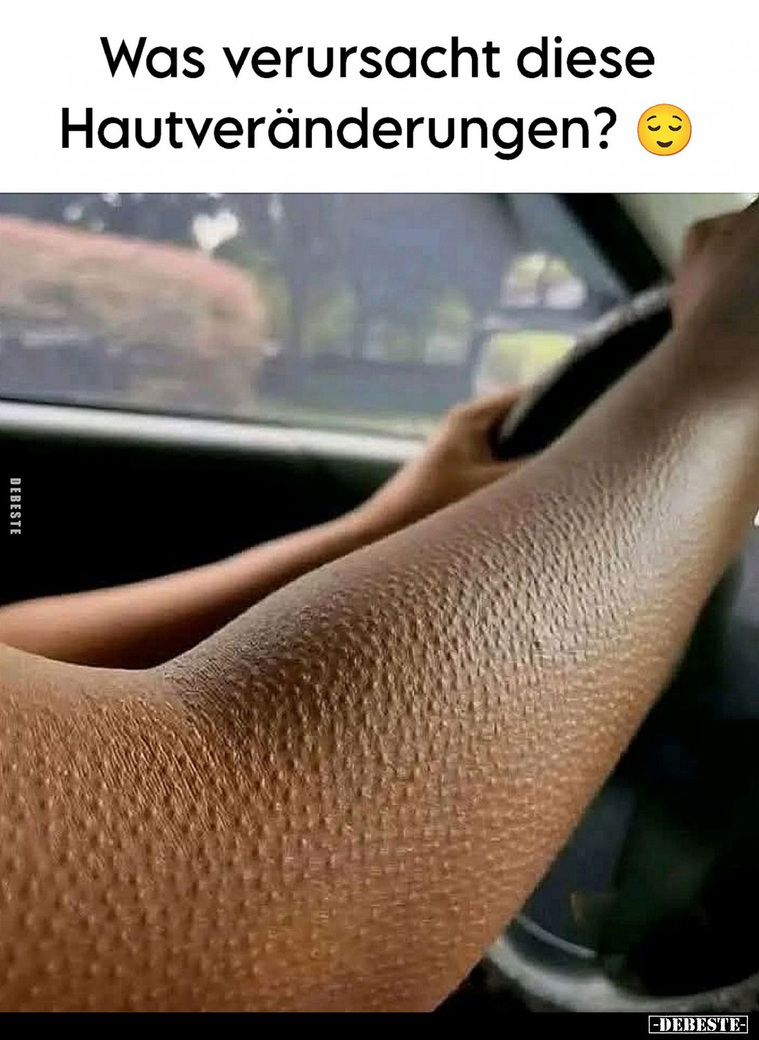 Was verursacht diese Hautveränderungen?