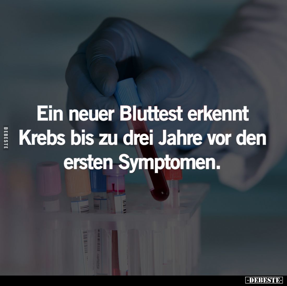 Ein neuer Bluttest erkennt Krebs bis zu drei Jahre vor den ersten Symptomen.