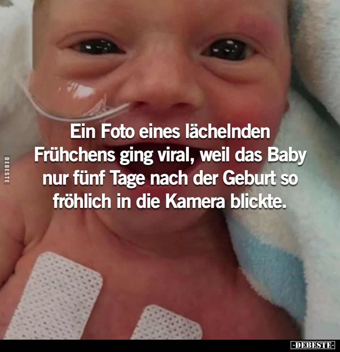 Ein Foto eines lächelnden Frühchens ging viral, weil das Baby nur fünf Tage nach der Geburt so fröhlich in die Kamera blickte...