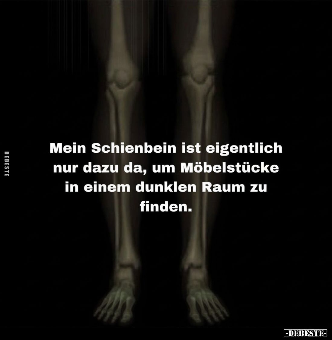 Mein Schienbein ist eigentlich nur dazu da, um Möbelstücke in einem dunklen Raum zu finden.
