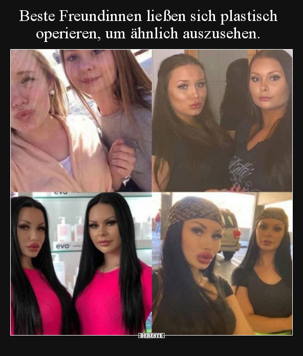 Beste Freundinnen ließen sich plastisch operieren, um.. - Lustige Bilder | DEBESTE.de