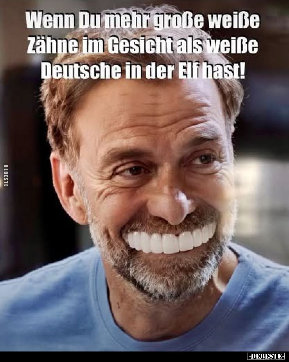 Wenn Du mehr große weiße Zähne im Gesicht als weiße Deutsche in der Elf hast!