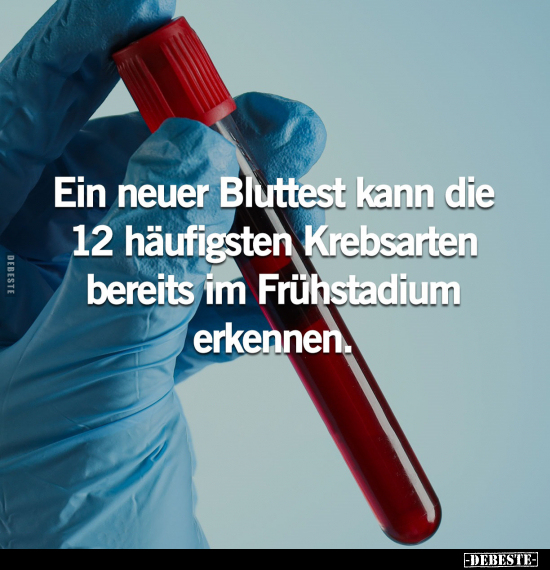 Ein neuer Bluttest kann die 12 häufigsten Krebsarten.. - Lustige Bilder | DEBESTE.de