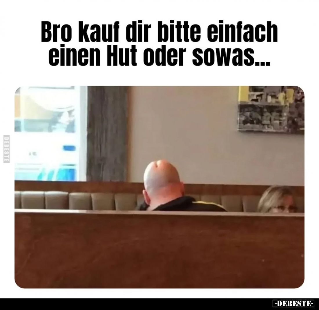 Bro kauf dir bitte einfach einen Hut oder sowas...