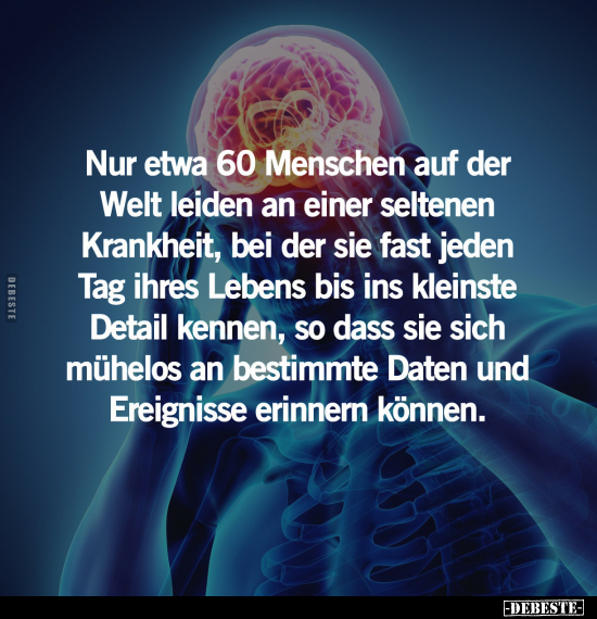Nur etwa 60 Menschen auf der Welt leiden an einer seltenen.. - Lustige Bilder | DEBESTE.de