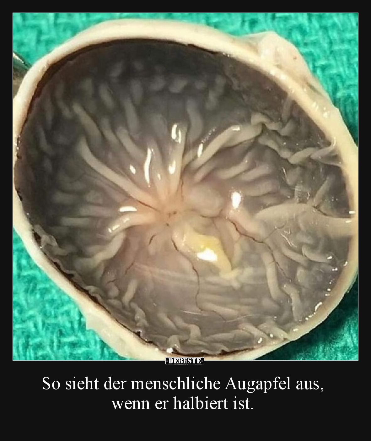 So sieht der menschliche Augapfel aus, wenn er halbiert ist.
