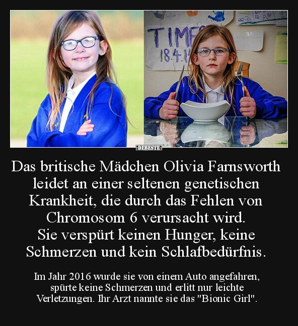 Das britische Mädchen Olivia Farnsworth leidet an einer.. - Lustige Bilder | DEBESTE.de