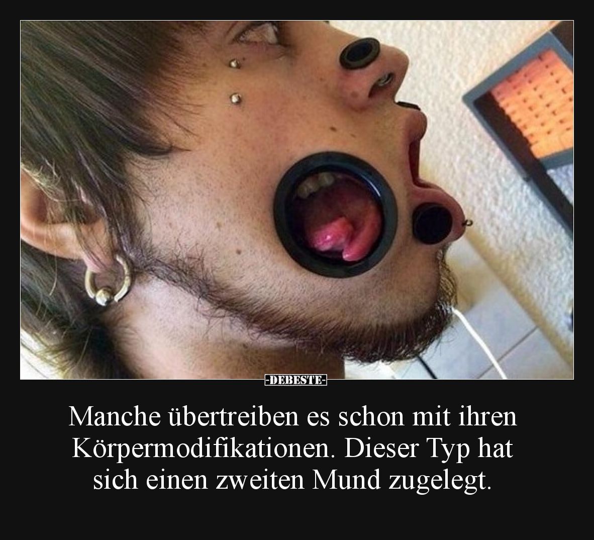 Manche übertreiben es schon mit ihren Körpermodifikationen. Dieser Typ hat sich einen zweiten Mund zugelegt.