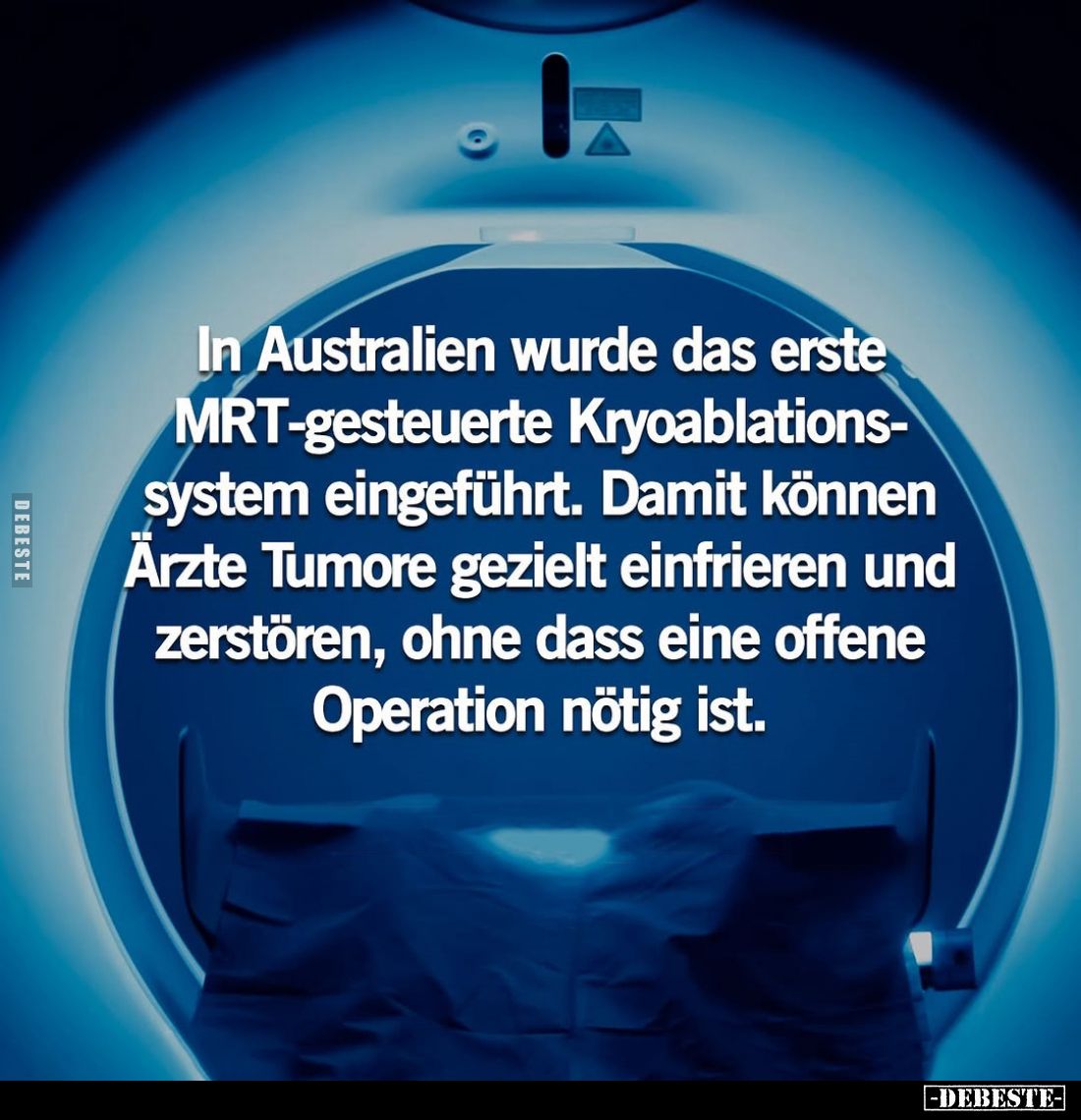 In Australien wurde das erste MRT-gesteuerte Kryoablationssystem eingeführt.
Damit können Ärzte Tumore gezielt einfrieren un...