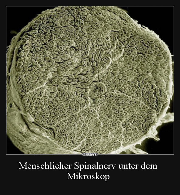 Menschlicher Spinalnerv unter dem Mikroskop.. - Lustige Bilder | DEBESTE.de