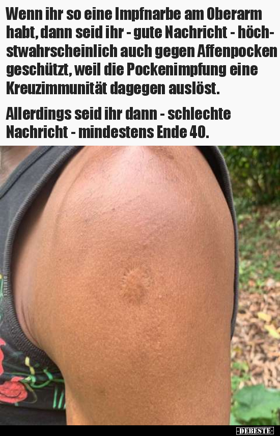 Wenn ihr so eine Impfnarbe am Oberarm habt, dann seid ihr.. - Lustige Bilder | DEBESTE.de