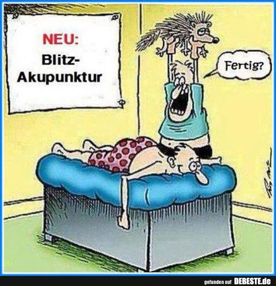 Neu: Blitz-Akupunktur. - Lustige Bilder | DEBESTE.de
