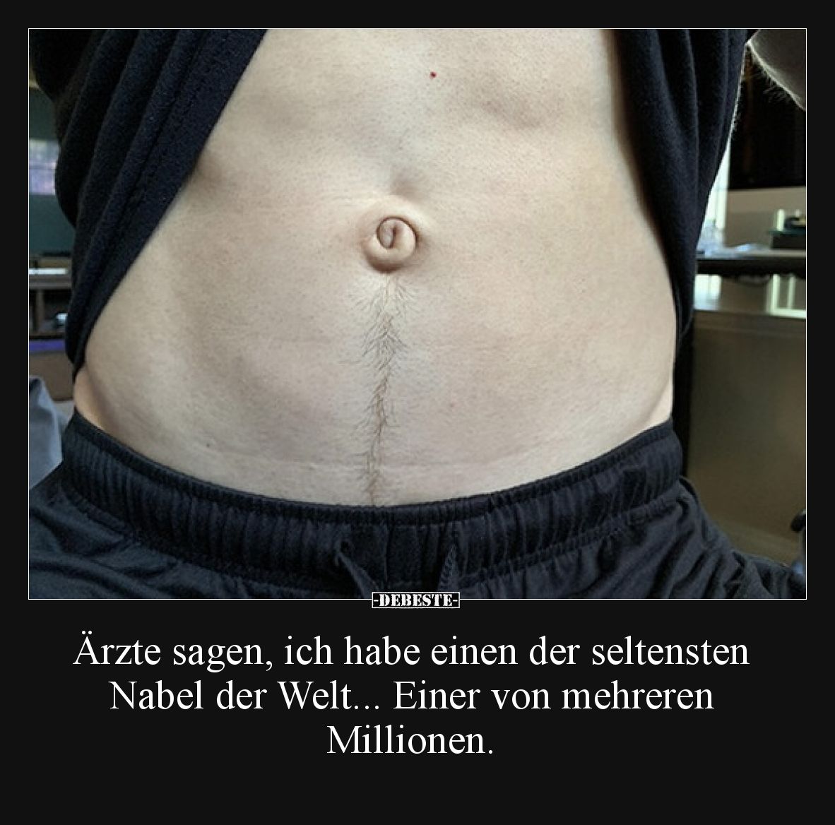 Ärzte sagen, ich habe einen der seltensten Nabel der Welt... Einer von mehreren Millionen.