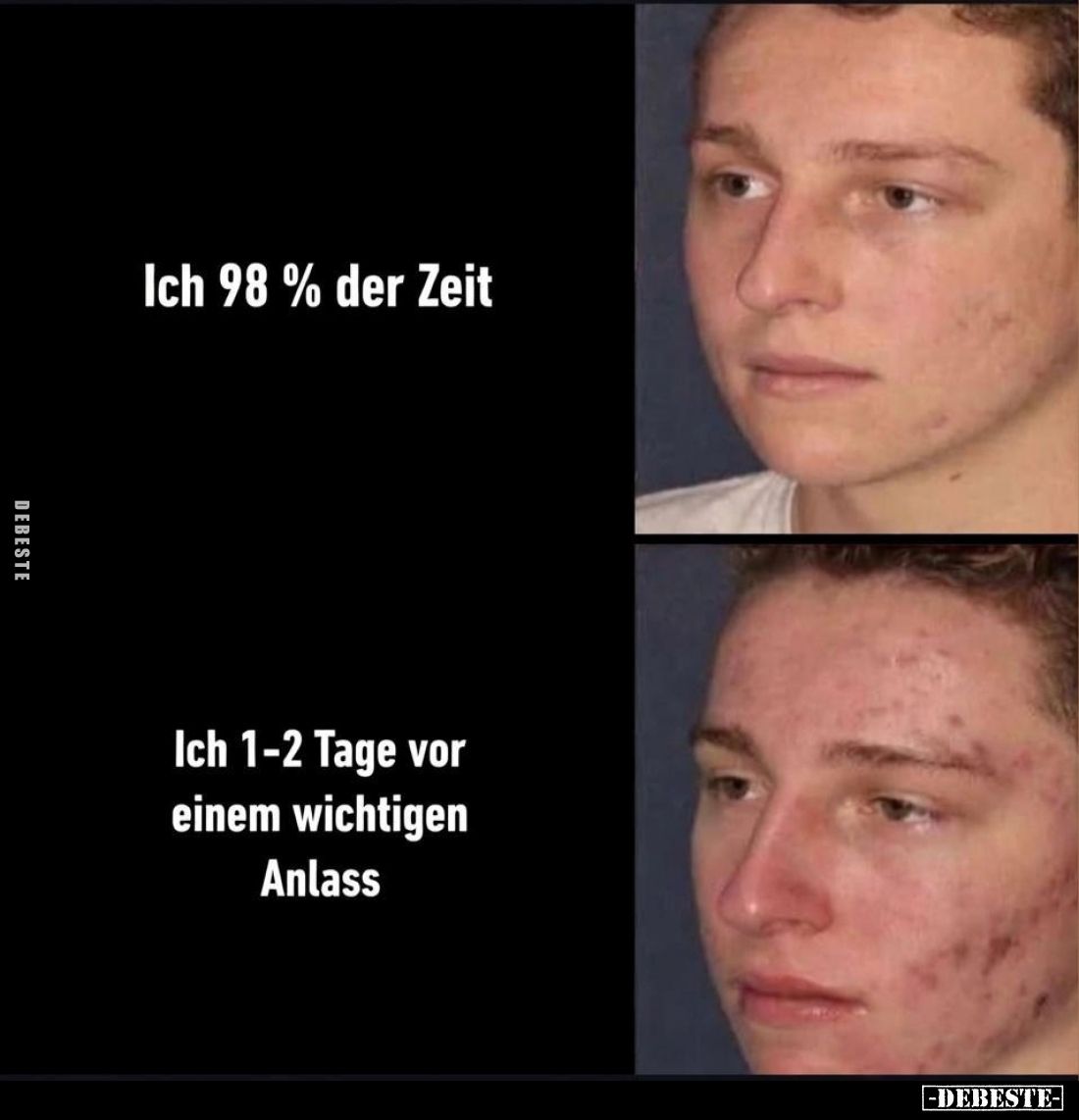 Ich 98 % der Zeit. Ich 1-2 Tage vor einem wichtigen Anlass.