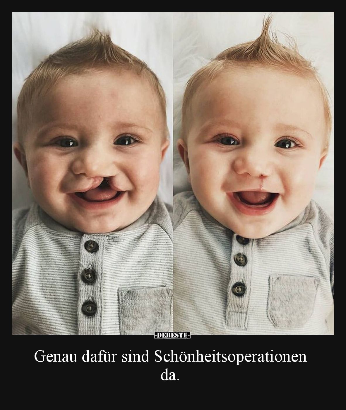 Genau dafür sind Schönheitsoperationen da.