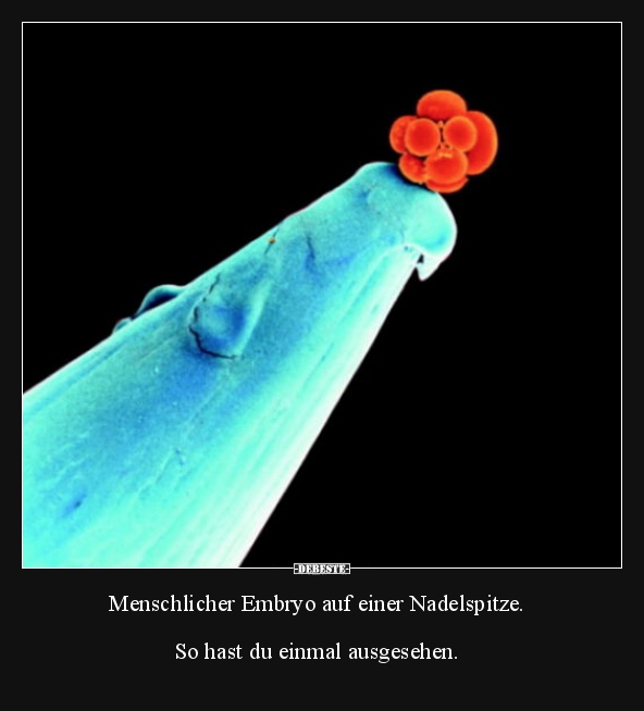 Menschlicher Embryo auf einer Nadelspitze.. - Lustige Bilder | DEBESTE.de