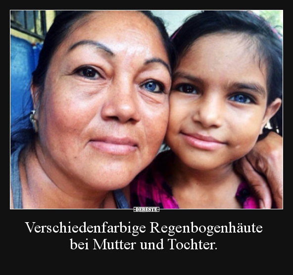 Verschiedenfarbige Regenbogenhäute bei Mutter und Tochter...