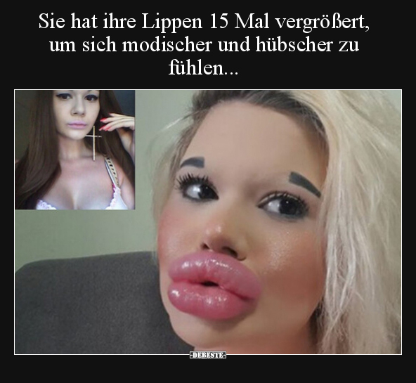 Sie hat ihre Lippen 15 Mal vergrößert, um sich modischer.. - Lustige Bilder | DEBESTE.de