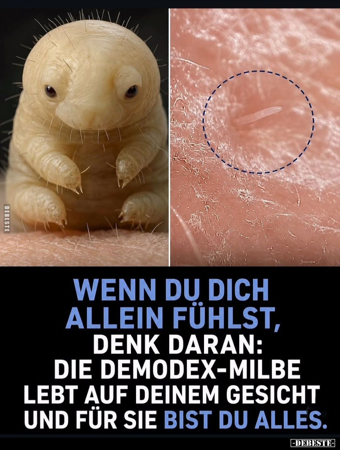 Wenn du dich allein fühlst,
denk daran: die Demodex-Milbe lebt auf deinem Gesicht. Und für sie bist du alles.